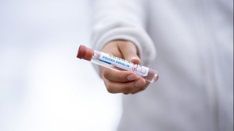 Oropharyngeal Secretions May Help To Reduce False Negative COVID-19 Test Results