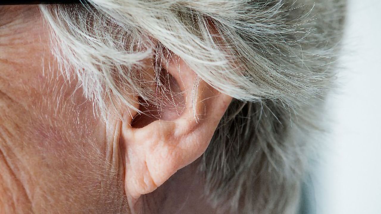 Brain Connectivity Changes Linked to Auditory Hallucinations
