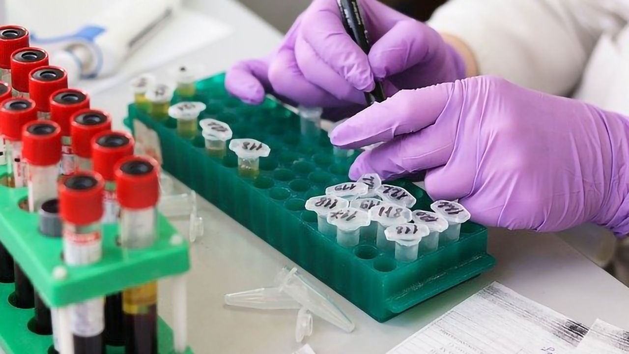 Only 5% of the Spanish Population Found To Have Antibodies to SARS-CoV-2
