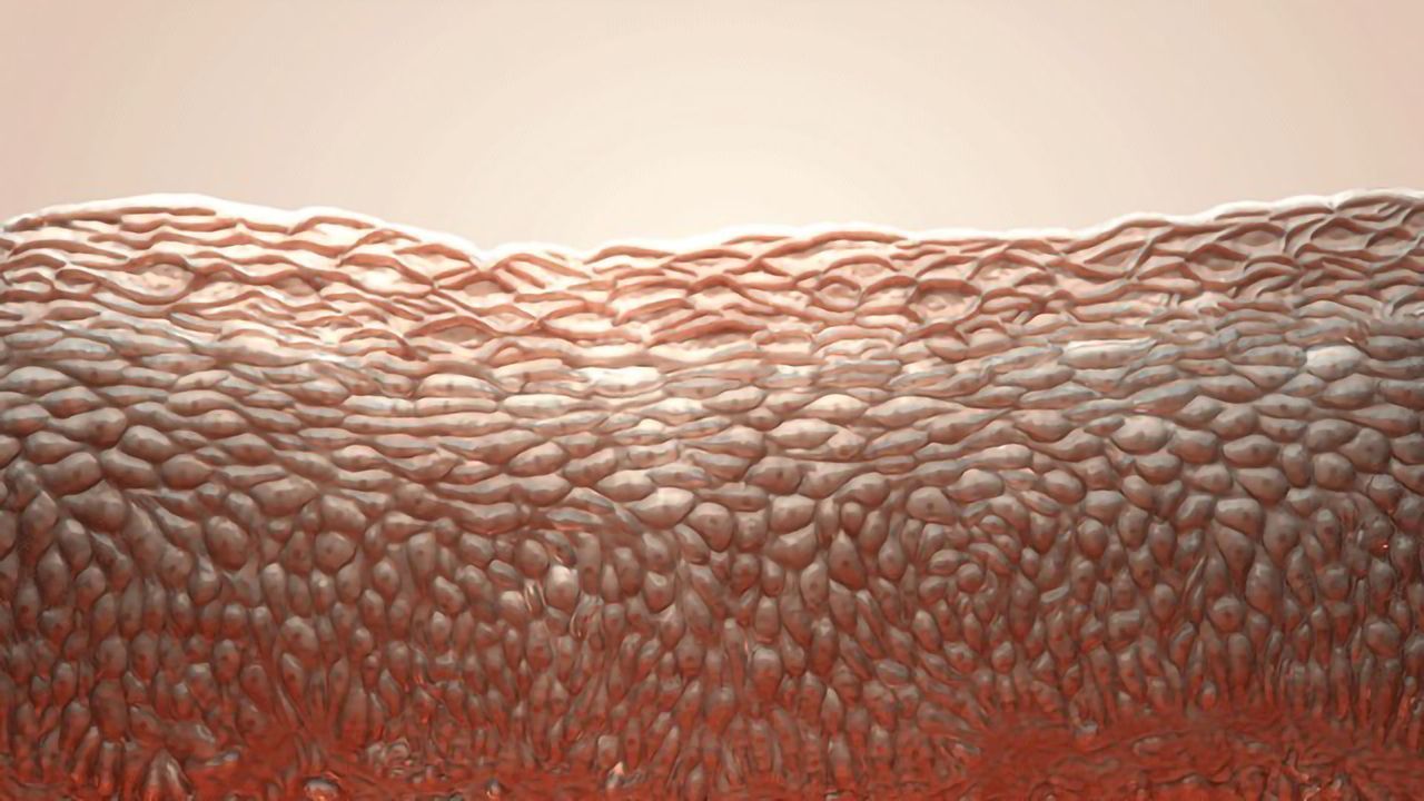 Team Pinpoints Protein That Causes Epithelial Cancers To Spread