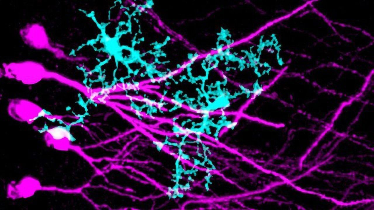 How Microglia Chomp Paths Through the Brain's Scaffolding To Promote Plasticity