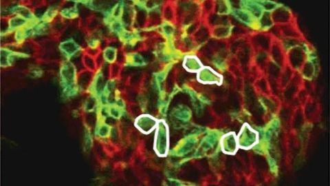 How Randomness and Collective Dynamics Define a Stem Cell