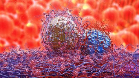 Blocking Cholesterol Storage Could Halt Pancreatic Tumor Growth
