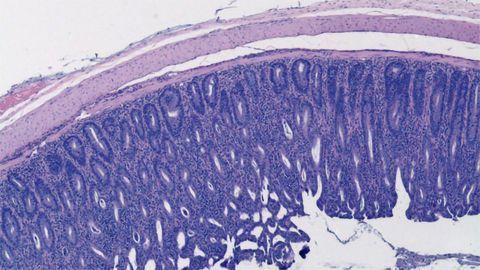 Regulatory T Cells Modified by Key Gene To Fine-tune the Immune Response
