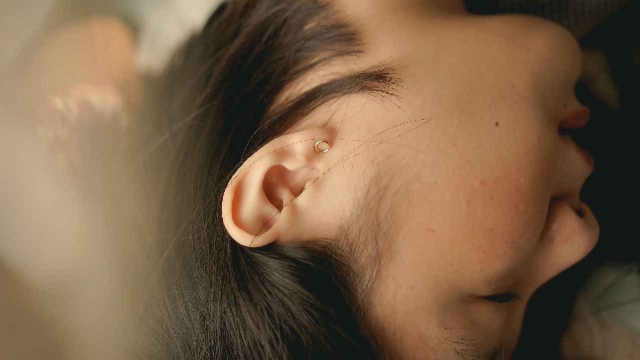 Common Genetic Variant Identified As Frequent Cause of Deafness