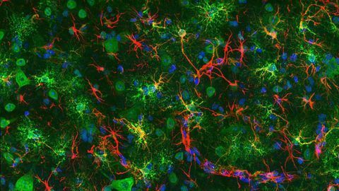 Mouse Spinal Cord Mouse Spinal Cord