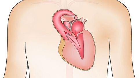 Heart Valve Disease Accelerated by Hyperactive Immune Cells