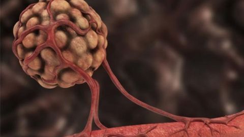 A Mirror-image Peptide Tumor Treatment