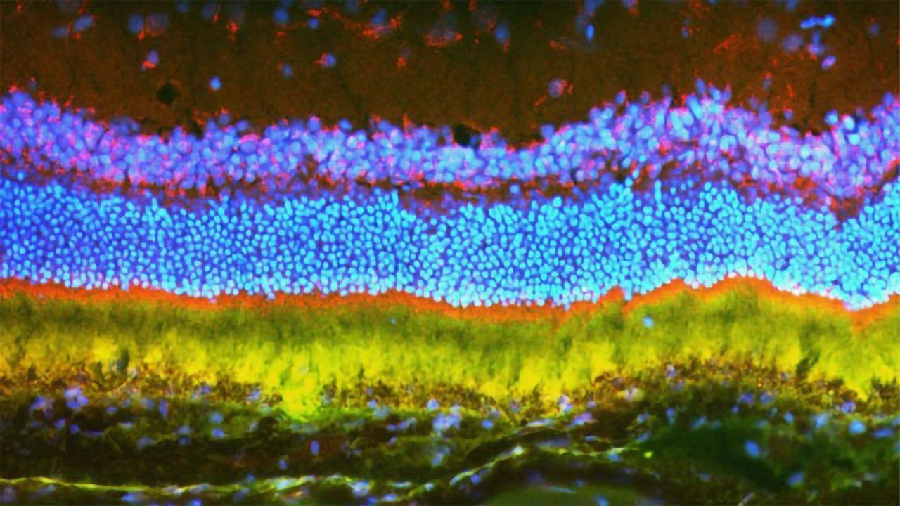 Success in Use of Nanoparticles To Deliver Gene Therapy for Eye Disease in Rodents