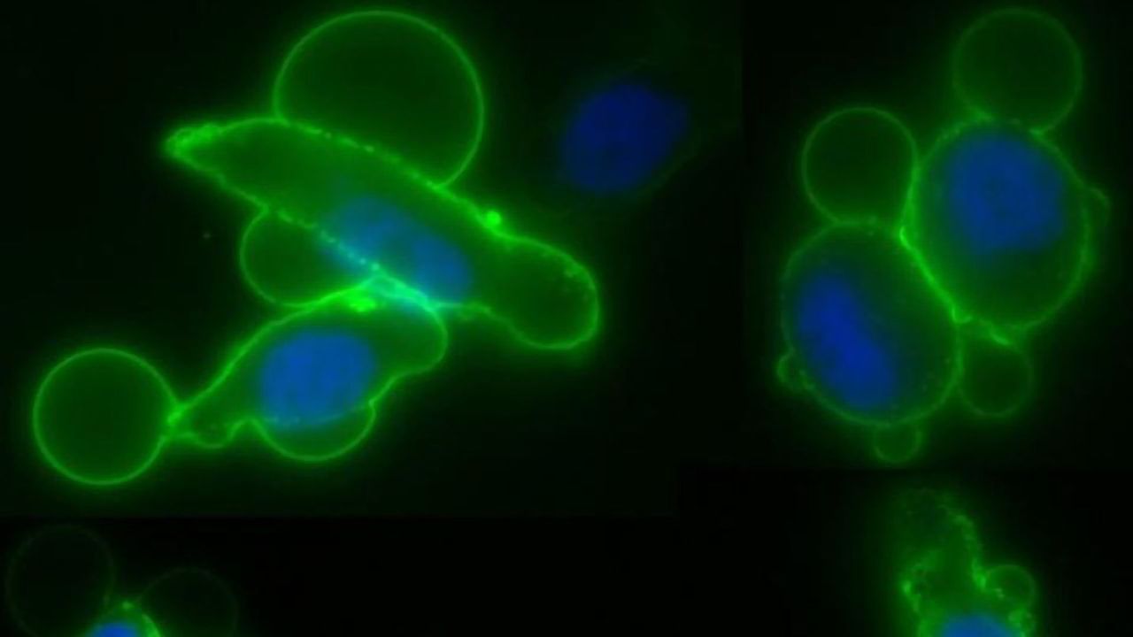 Extracellular Vesicles Promote the Spread of Cancer in the Bloodstream