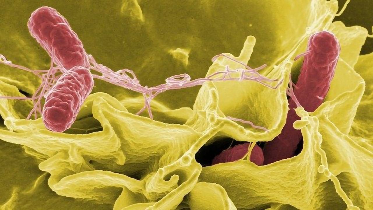 Food Poisoning Bacteria Causes Autoimmunity and May Be Linked to Alzheimer’s and Parkinson’s