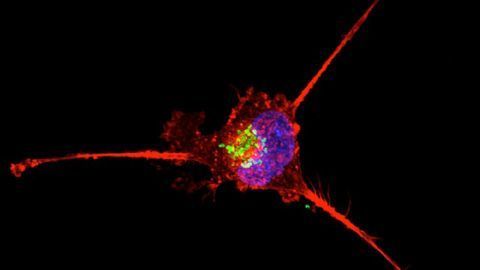 Blood-based Biomarkers Can Help To Predict Recurrence of Triple Negative Breast Cancer