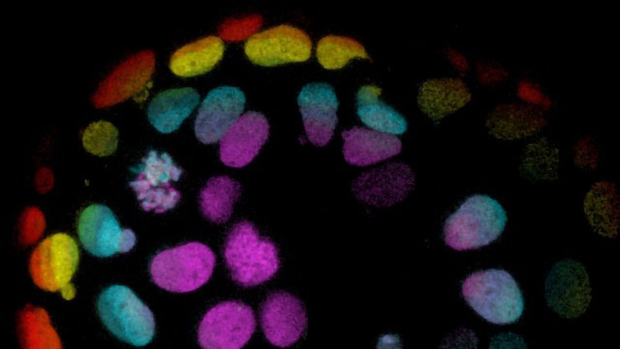 Liver Organoid Offers New Promise for Transplantation and the Study of Liver Disease