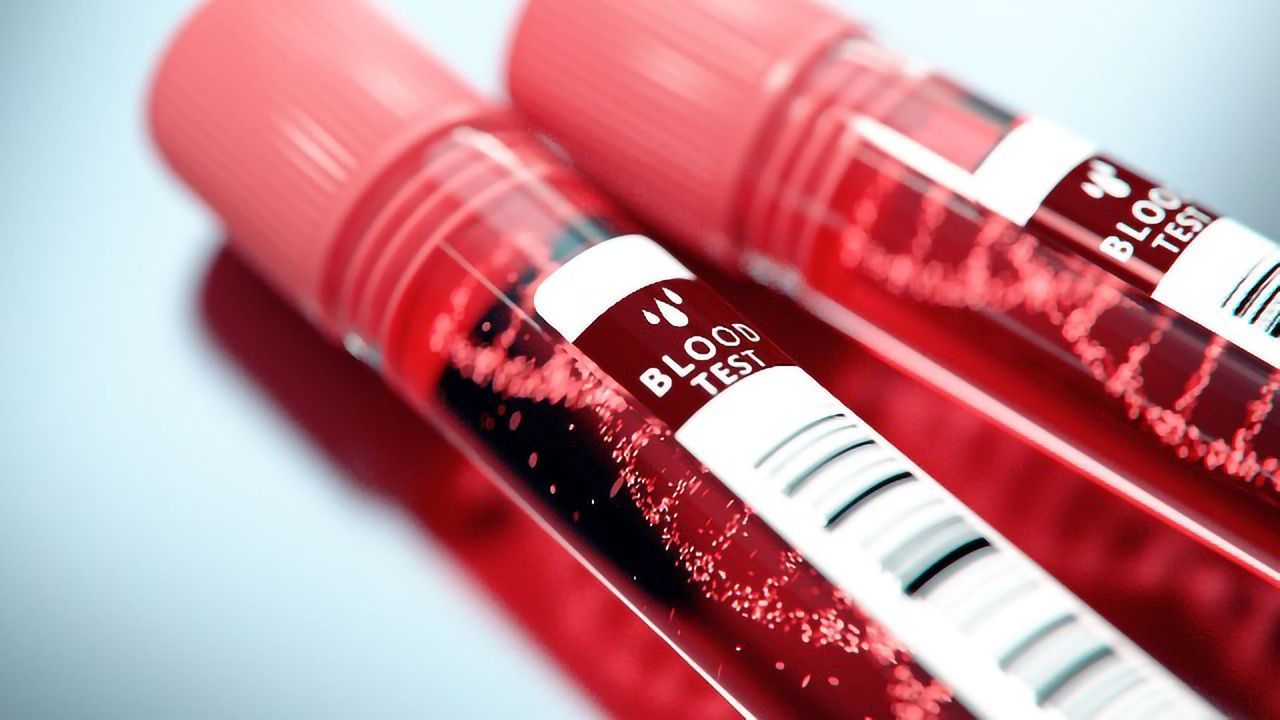 Blood Test Detects Over 50 Different Cancers With a 0.7% False-Positive Rate