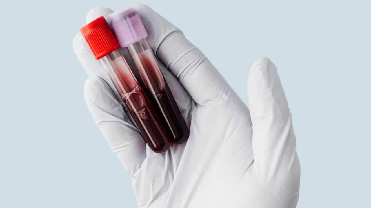 Lab-on-a-Chip Detects Blood Type Within Minutes