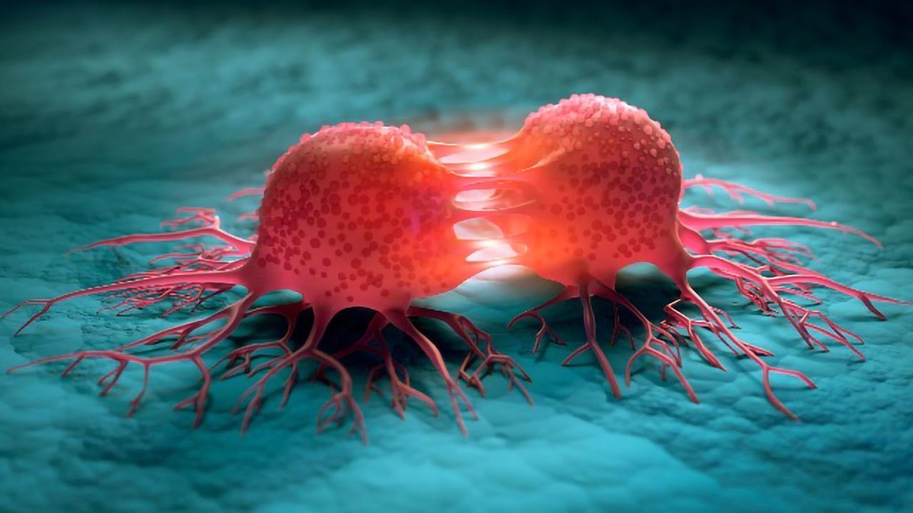 New Strategy To Stop the Spread of Childhood Bone Cancer