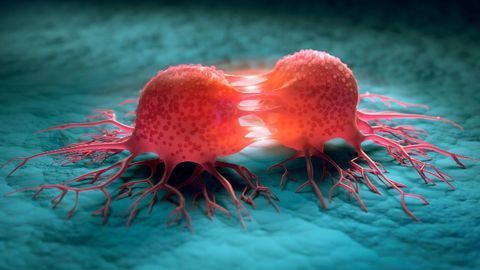 New Strategy To Stop the Spread of Childhood Bone Cancer