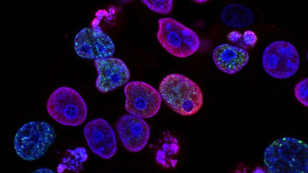 Advances in Phenotypic Screening: A Turning Point for Drug Discovery?