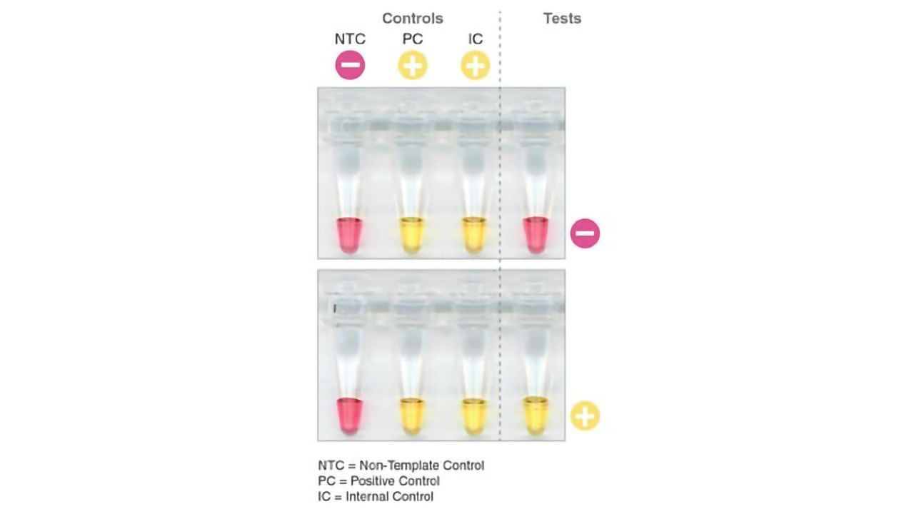 SARS-CoV-2 Rapid Colorimetric LAMP Assay Kit Enables Visual Detection of Novel Coronavirus