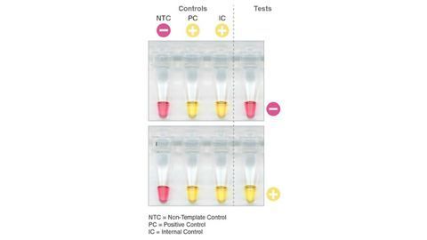 SARS-CoV-2 Rapid Colorimetric LAMP Assay Kit Enables Visual Detection of Novel Coronavirus