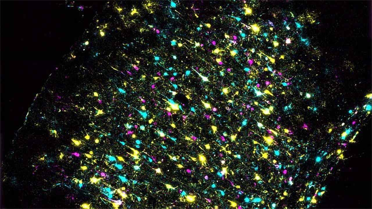 Mapping Connections in the Mouse Brain