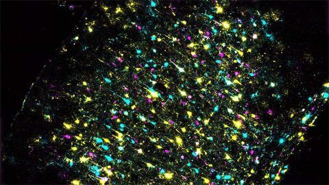 Mapping Connections in the Mouse Brain Mapping Connections in the Mouse Brain