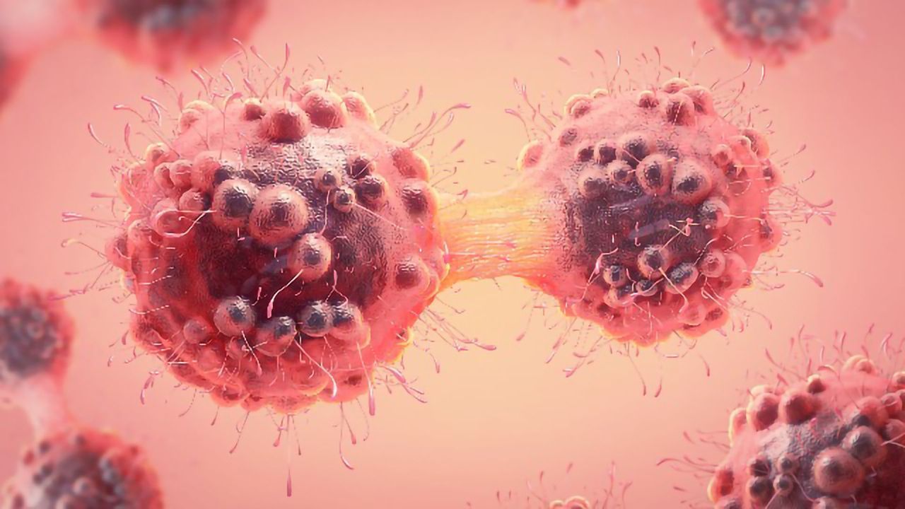 Imaging Mass Spectrometry Identifies Carcinoma Tumor Markers