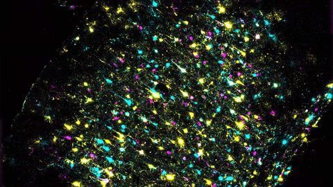 Mapping Brain Connections With DNA Barcodes