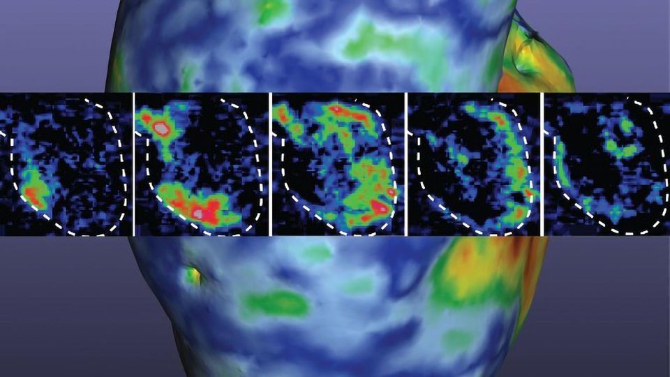 Researchers 3D Bioprint a Working Heart Pump content piece image