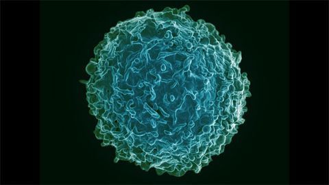 Blood Test Could Reveal When Rheumatoid Arthritis Will Strike