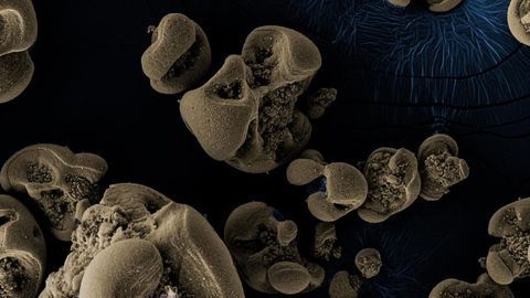 Metal-eating Bacteria Discovered Accidentally on Dirty Labwear