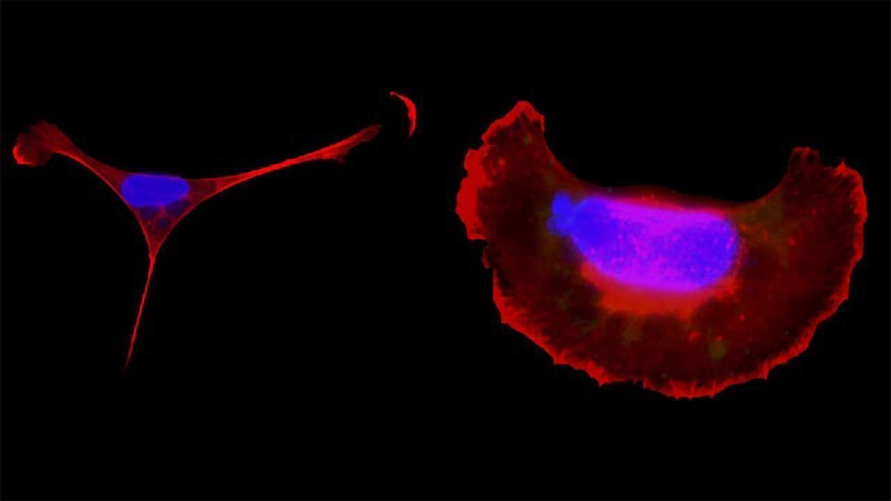 Toxoplasma Host Cells
