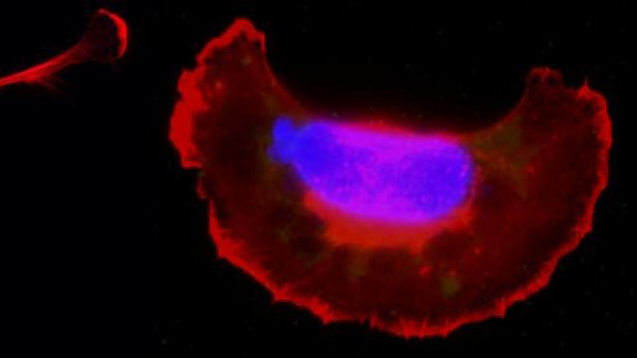Toxoplasma at the Wheel: Study Reveals How Parasite Controls Its Host Cell To Spread Around the Body