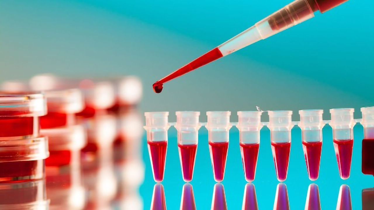 Breakthrough: New Blood Test Detects Positive COVID-19 Result in 20 minutes