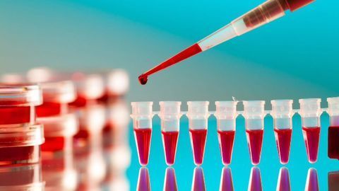 Breakthrough: New Blood Test Detects Positive COVID-19 Result in 20 minutes