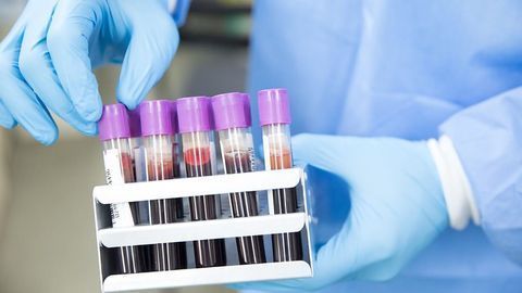 Widely Used Blood Test Could Advance Heart Failure Treatment