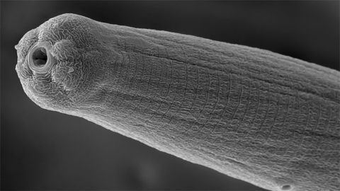 Nematode Preparing to Spit Nematode Preparing to Spit