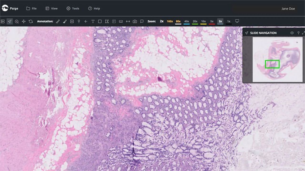 Paige Receives FDA Clearance for the FullFocus Viewer for Digital Pathology