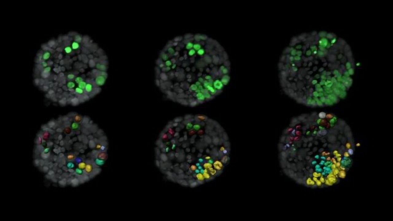 Neighboring Mutated Cells Help Kickstart Breast Cancer