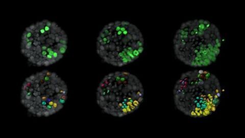 Neighboring Mutated Cells Help Kickstart Breast Cancer