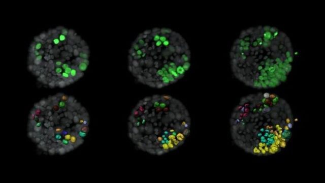 Neighboring Mutated Cells Help Kickstart Breast Cancer content piece image 