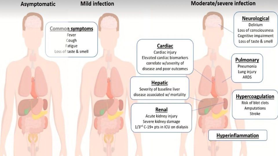 Teach Me in 10 – Understanding COVID-19 Through 