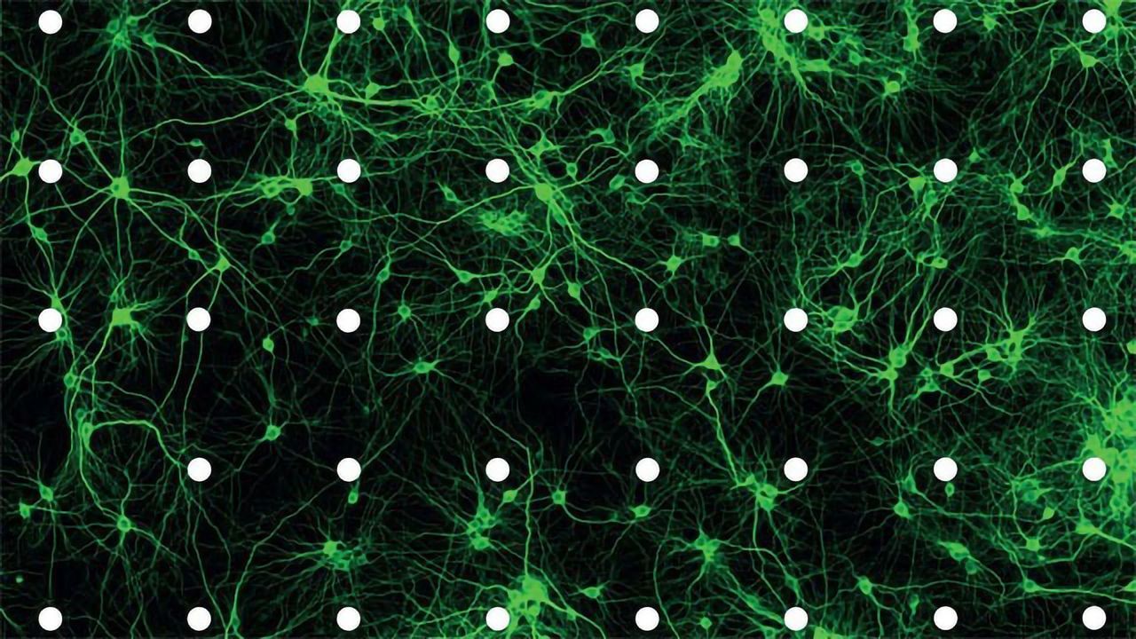 Calcium Channel Subunits May Play a Crucial Role in Autism