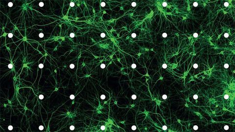 Calcium Channel Subunits May Play a Crucial Role in Autism