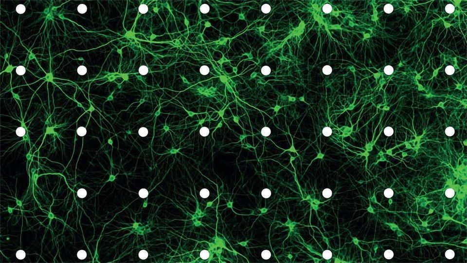 Calcium Channel Subunits May Play a Crucial Role in Autism content piece image