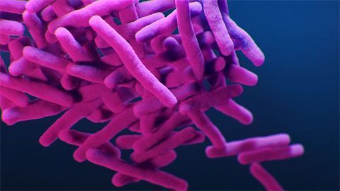 Drug-Resistant Tuberculosis Drug-Resistant Tuberculosis