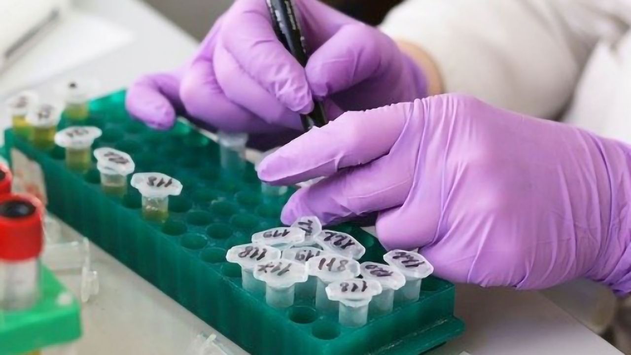 Mass Spec-Based Urine Test Could Improve Adrenal Cancer Diagnoses