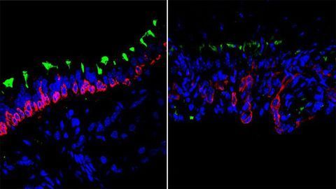 Stem Cells in Young vs. Old Airways Stem Cells in Young vs. Old Airways
