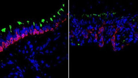 How Airway Cells Work Together in Regeneration and Aging