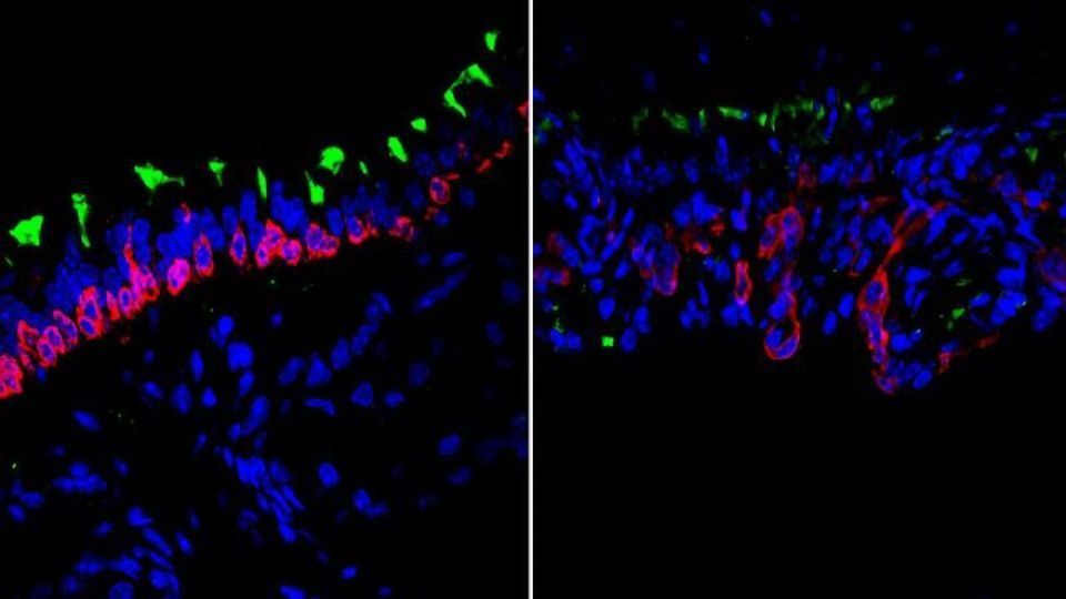 How Airway Cells Work Together in Regeneration and Aging content piece image